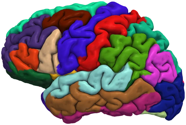 Left hemisphere of the same subject with the regions of the Desikan-Killiany atlas on its cortical surface