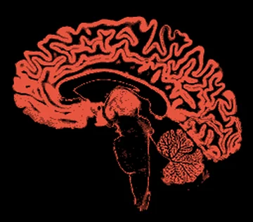 Gray matter map of the same slice