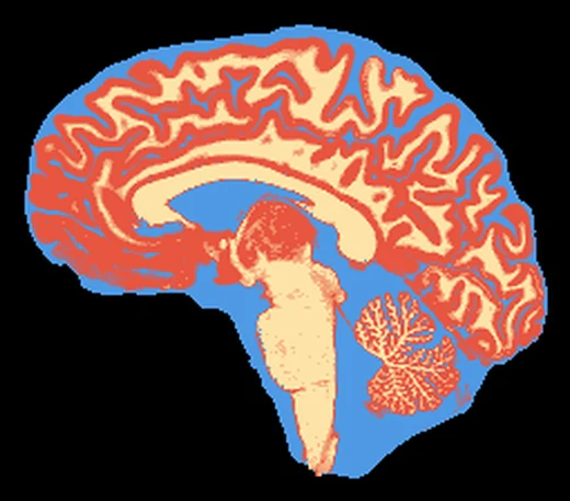 Tissue label map of the same slice: CSF in blue, gray matter in red-orange and white matter in cream, blended where a voxel holds two tissues