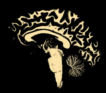 White matter map of the same slice