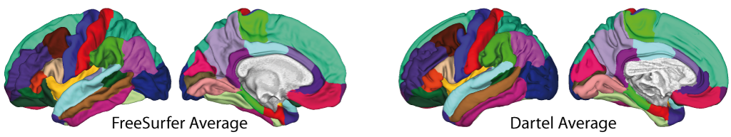 Desikan Killiany et al. 2006