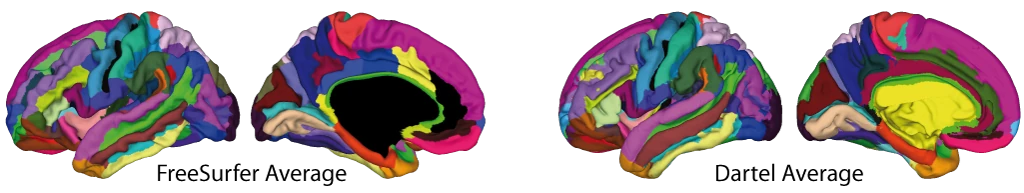 Destrieux atlas shown on the FreeSurfer and Dartel average surfaces